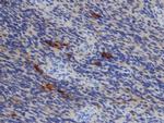 TIMP1 Antibody in Immunohistochemistry (Paraffin) (IHC (P))