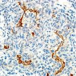 c-Met Antibody in Immunohistochemistry (Paraffin) (IHC (P))