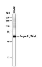 PAI1 Antibody in Western Blot (WB)