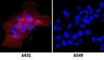 ICAM-1 Monoclonal Antibody (14C11)