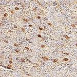 OLIG1/OLIG2/OLIG3 Monoclonal Antibody (257224)