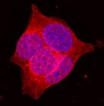 GLUT2 Monoclonal Antibody (205115)