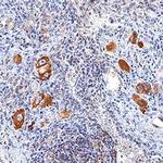 CD273 (B7-DC) Antibody in Immunohistochemistry (Paraffin) (IHC (P))