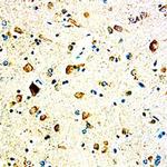 GASP1 Monoclonal Antibody (288518)