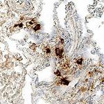 TPSB2 Monoclonal Antibody (349406)