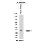 Trypsin 2 Antibody in Immunoprecipitation (IP)