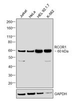RCOR1 Antibody in Western Blot (WB)