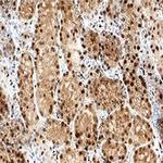 NMNAT1 Monoclonal Antibody (675112)