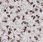 FZD3 Antibody in Immunohistochemistry (Paraffin) (IHC (P))