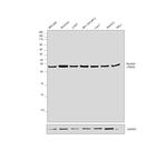 RhoGDI Antibody in Western Blot (WB)