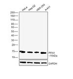 Profilin 1 Antibody in Western Blot (WB)