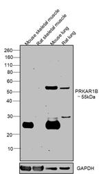 PRKAR1B Antibody in Western Blot (WB)