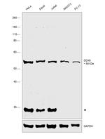 DDX6 Antibody in Western Blot (WB)