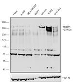 53BP1 Antibody in Western Blot (WB)