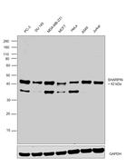 SHARPIN Monoclonal Antibody (OTI1F4)