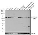 ATP6V1A Antibody