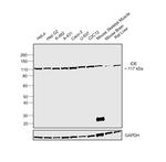 IDE Antibody in Western Blot (WB)