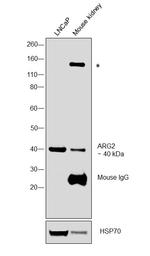 Arginase 2 Antibody in Western Blot (WB)