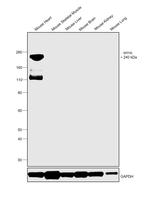 MYH6 Monoclonal Antibody (GT5612)