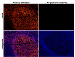 CD19 Antibody in Immunohistochemistry (IHC)