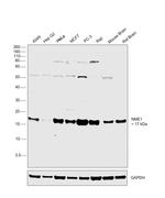 NME1 Antibody in Western Blot (WB)