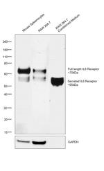 IL-6 Receptor Recombinant Rabbit Monoclonal Antibody (033)