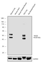RAGE Recombinant Rabbit Monoclonal Antibody (005)
