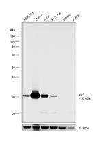 Carbonic Anhydrase II Recombinant Rabbit Monoclonal Antibody (004)