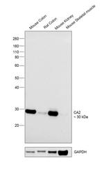 Carbonic Anhydrase II Recombinant Rabbit Monoclonal Antibody (002)