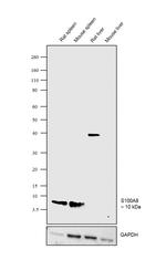 S100A8 Recombinant Rabbit Monoclonal Antibody (008)