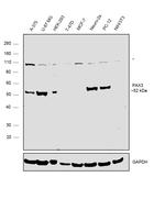 PAX3 Monoclonal Antibody (GT2411)
