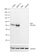 CD4 Antibody in Western Blot (WB)