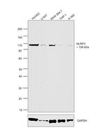 NLRP3 Antibody in Western Blot (WB)