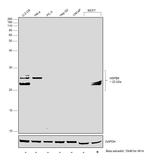 HSPB8 Antibody in Western Blot (WB)
