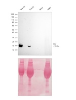Transthyretin Antibody