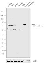 NUMB Antibody in Western Blot (WB)