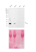Transthyretin Antibody in Western Blot (WB)