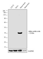 alpha-Cardiac Actin Antibody in Western Blot (WB)