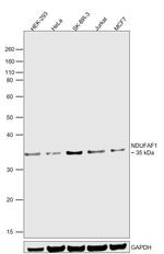NDUFAF1 Antibody in Western Blot (WB)