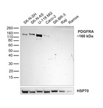 PDGFRA Antibody in Western Blot (WB)