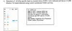 Herpes Simplex Virus Type 1/2 TK Antibody in Western Blot (WB)