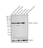 EPHX2 Recombinant Rabbit Monoclonal Antibody (JE64-07)