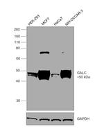 GALC Antibody in Western Blot (WB)