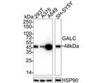 GALC Antibody in Western Blot (WB)
