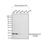 LIF Recombinant Rabbit Monoclonal Antibody (PSH05-96)