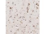 ASAH1 Antibody in Immunohistochemistry (Paraffin) (IHC (P))