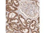 ASAH1 Antibody in Immunohistochemistry (Paraffin) (IHC (P))