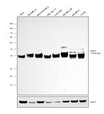 ASAH1 Antibody in Western Blot (WB)