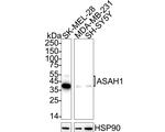ASAH1 Antibody in Western Blot (WB)