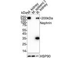 Nephrin Antibody in Western Blot (WB)